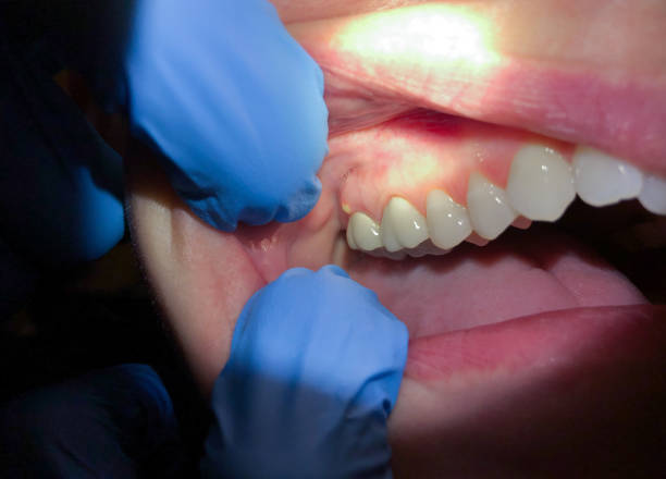 Best Emergency Tooth Extraction in Regency At Monroe, NJ