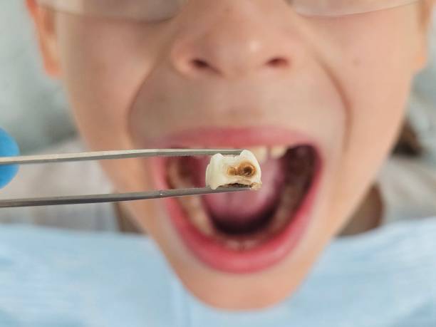 Best Same-Day Emergency Dental Services in Regency At Monroe, NJ