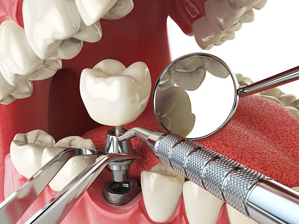 Best Emergency Dental Care for Broken or Chipped Teeth in Regency At Monroe, NJ